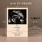 Pregnancy Announcement for Grandparents – Personalized Ultrasound Wood Frame