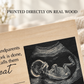 Great Grandma Pregnancy Announcement – Personalized Ultrasound Wood Frame
